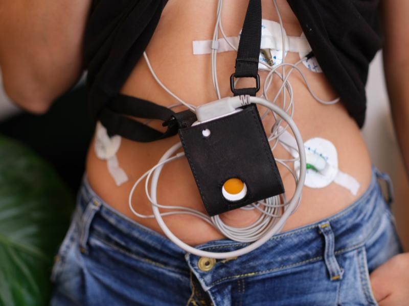 Como Funciona o Exame Holter 24h para Monitorar o Coração?