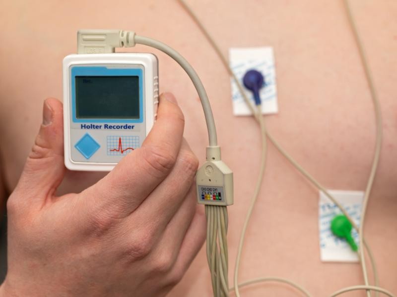 Holter: O Que É e Como Funciona Este Exame Cardiológico