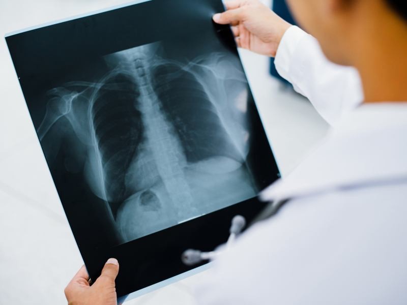 Quais Problemas Podem ser Diagnosticados com o Exame de Raio-X?