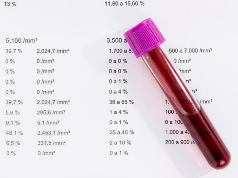 Quais Doenças Podem Ser Diagnosticadas no Hemograma? Entenda os Sinais que Seu Corpo Está Dando